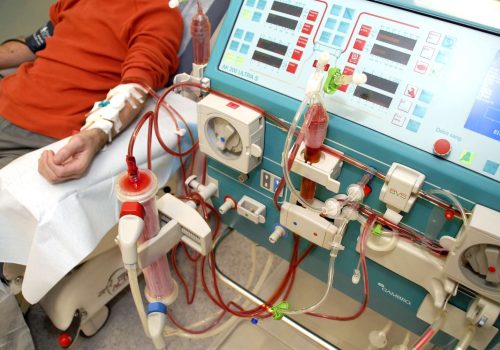 DIALYSIS